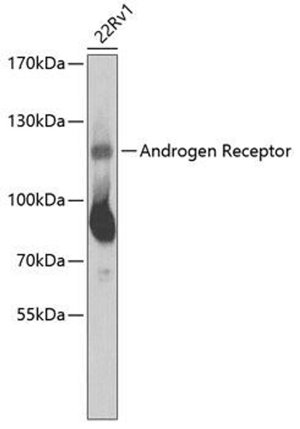 Epigenetics and Nuclear Signaling Antibodies 3 Anti-Androgen Receptor Antibody CAB2053