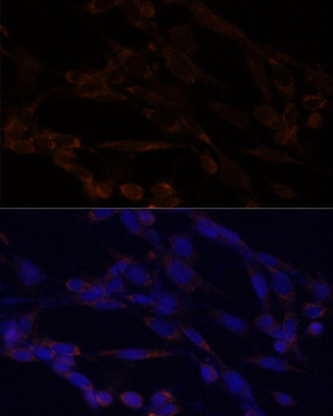 Cell Biology Antibodies 8 Anti-IKKAlpha Antibody CAB2062