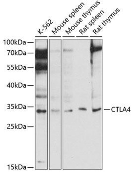 Immunology Antibodies 2 Anti-CTLA4 Antibody CAB2063