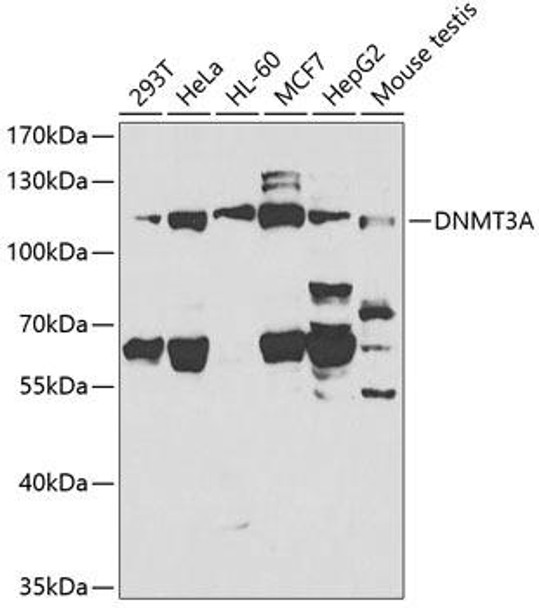 Cell Biology Antibodies 8 Anti-DNMT3A Antibody CAB2065