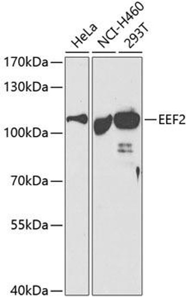 Metabolism Antibodies 2 Anti-EEF2 Antibody CAB2068