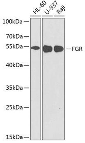 Immunology Antibodies 2 Anti-FGR Antibody CAB2075