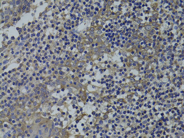 Cell Biology Antibodies 8 Anti-GNA15 Antibody CAB2080