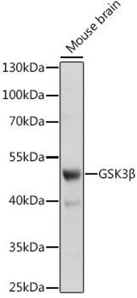 Cell Biology Antibodies 8 Anti-GSK3Beta Antibody CAB2081