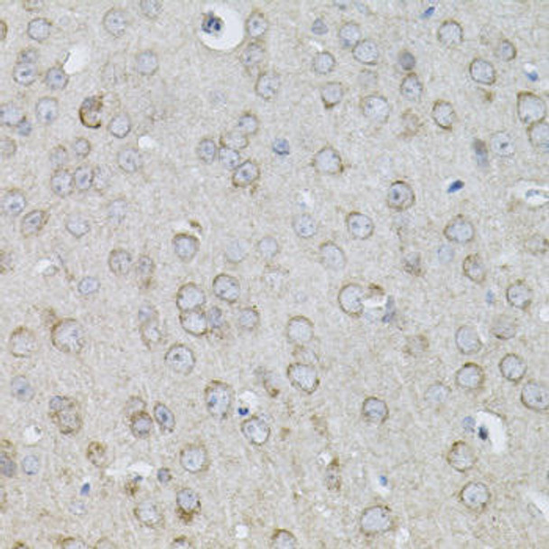 Cell Biology Antibodies 8 Anti-IL-13 Antibody CAB2089