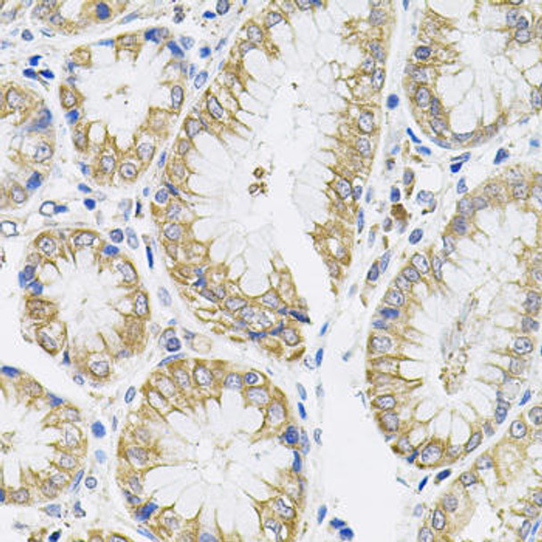 Cell Biology Antibodies 8 Anti-IL-13 Antibody CAB2089