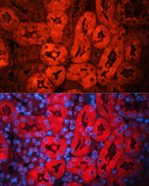 Cell Death Antibodies 1 Anti-LCN2 Antibody CAB2092