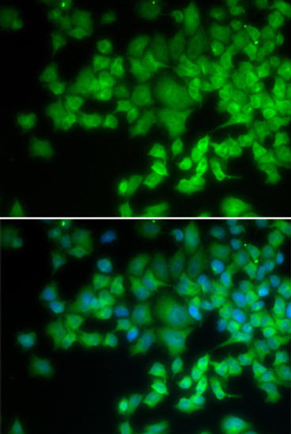 Cell Biology Antibodies 8 Anti-NCF4 Antibody CAB2096