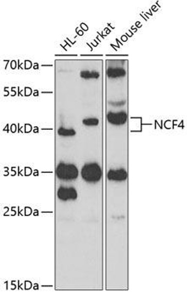 Cell Biology Antibodies 8 Anti-NCF4 Antibody CAB2096