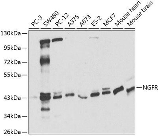 Cell Death Antibodies 1 Anti-NGFR Antibody CAB2097