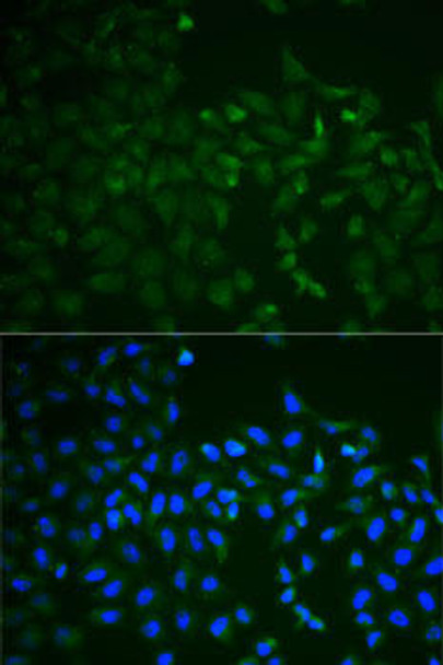 Cell Death Antibodies 1 Anti-TNFRSF11B Antibody CAB2100