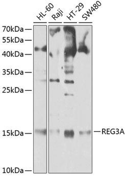 Immunology Antibodies 2 Anti-REG3A Antibody CAB2101