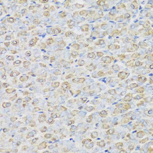 Immunology Antibodies 2 Anti-REG3A Antibody CAB2101