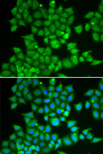 Cell Biology Antibodies 8 Anti-PDE1B Antibody CAB2102