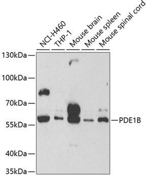 Cell Biology Antibodies 8 Anti-PDE1B Antibody CAB2102