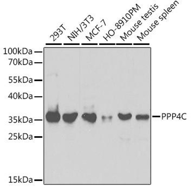 Cell Biology Antibodies 8 Anti-PPP4C Antibody CAB2109
