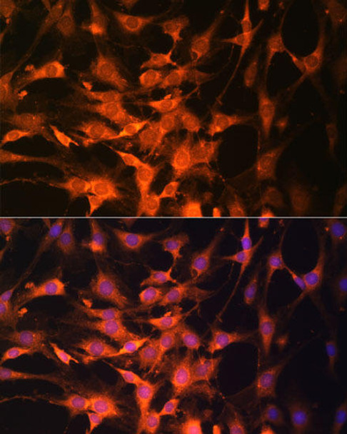 Cell Death Antibodies 1 Anti-PTEN Antibody CAB2113