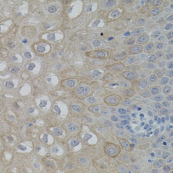 Cardiovascular Antibodies Anti-FAK Antibody CAB2114