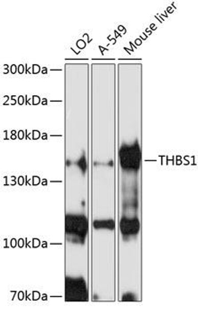 Cell Biology Antibodies 8 Anti-THBS1 Antibody CAB2125