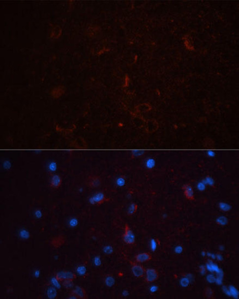 Cell Biology Antibodies 8 Anti-THY1 Antibody CAB2126