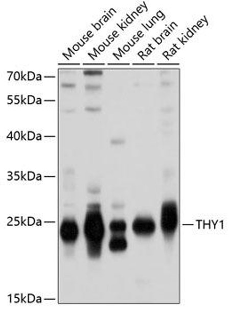 Cell Biology Antibodies 8 Anti-THY1 Antibody CAB2126