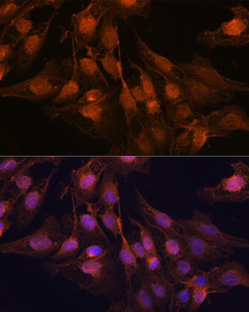 Signal Transduction Antibodies 2 Anti-UCHL1 Antibody CAB2131