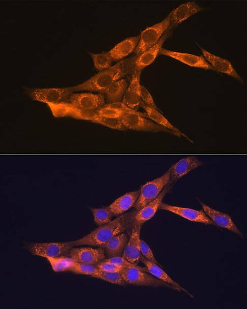 Cell Biology Antibodies 8 Anti-VEGFB Antibody CAB2132