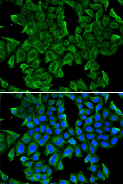 Cell Biology Antibodies 16 Anti-REG3G Antibody CAB2146