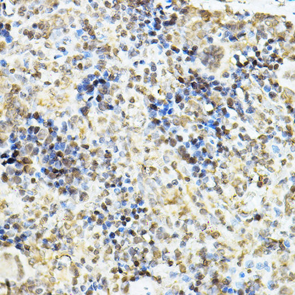 Cell Death Antibodies 1 Anti-NR3C1 Antibody CAB2164