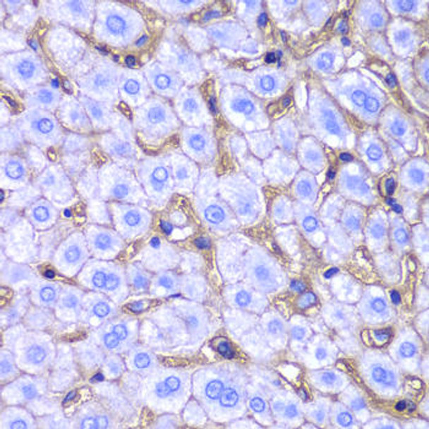Cell Biology Antibodies 8 Anti-HLA-A Antibody CAB2167