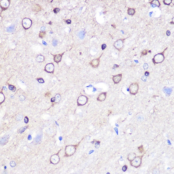 Developmental Biology Anti-STMN1 Antibody CAB2176