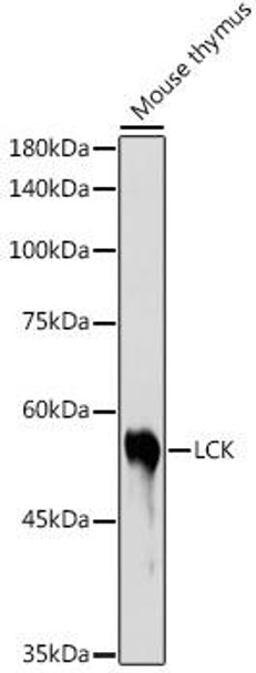 Immunology Antibodies 2 Anti-LCK Antibody CAB2177