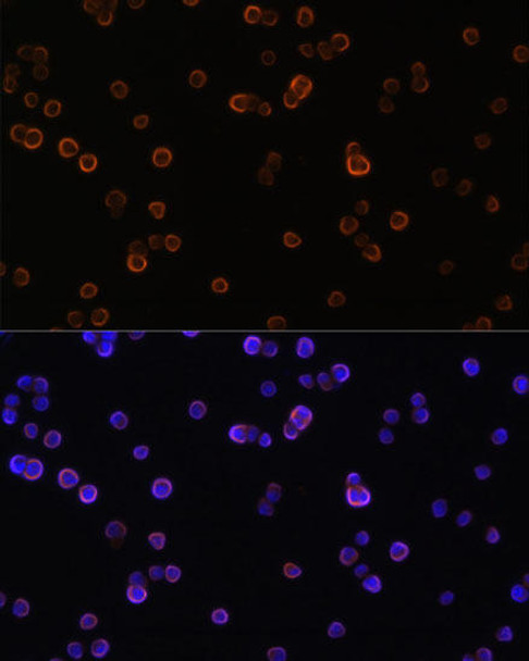 Metabolism Antibodies 2 Anti-PLCG2 Antibody CAB2182