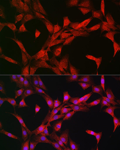 Cell Death Antibodies 1 Anti-p70 S6 kinase Antibody CAB2190