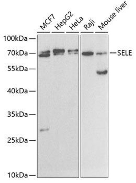 Cell Biology Antibodies 8 Anti-SELE Antibody CAB2191
