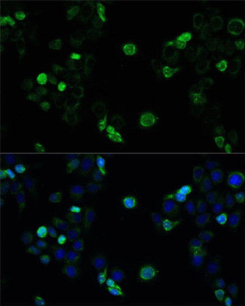 Signal Transduction Antibodies 2 Anti-MRP4 / ABCC4 Antibody CAB2198