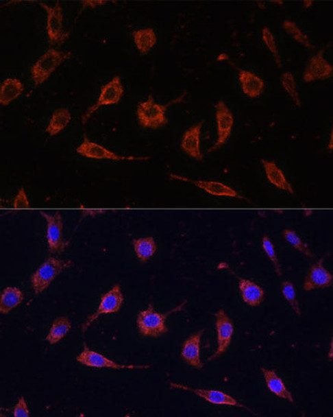 Autophagy Antibodies Anti-TOLLIP Antibody CAB2202