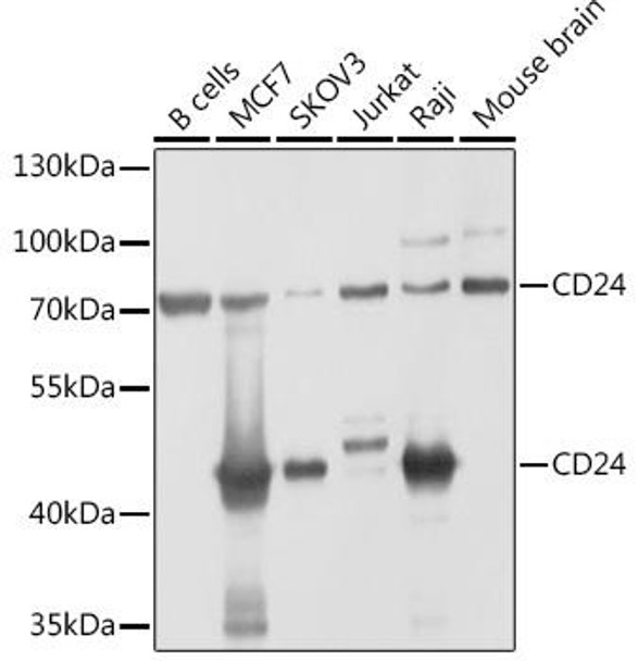 Cell Biology Antibodies 8 Anti-CD24 Antibody CAB2207