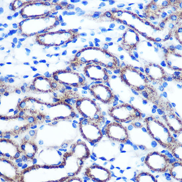 Cell Cycle Antibodies 1 Anti-TSG101 Antibody CAB2216