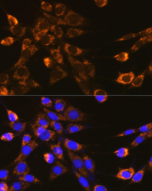 Cell Biology Antibodies 8 Anti-ITGB1 Antibody CAB2217