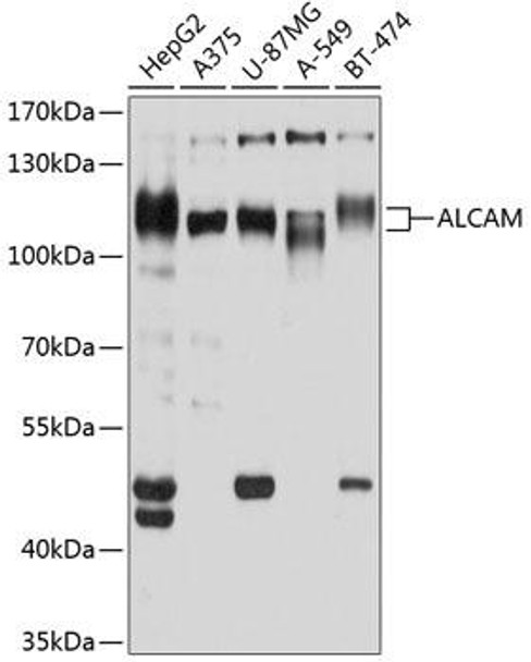 Immunology Antibodies 2 Anti-ALCAM Antibody CAB2218