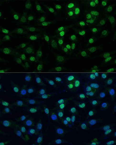 Immunology Antibodies 2 Anti-TRIM28 Antibody CAB2245