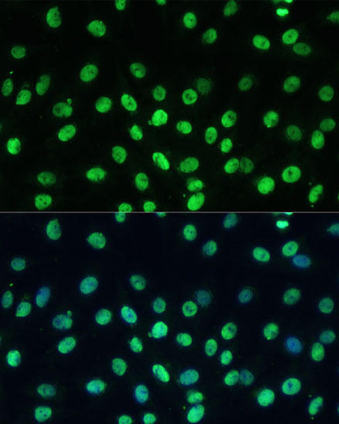 Immunology Antibodies 2 Anti-TRIM28 Antibody CAB2245