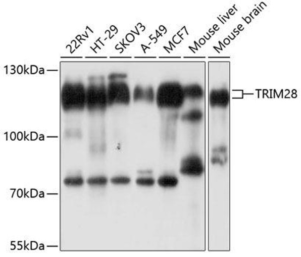 Immunology Antibodies 2 Anti-TRIM28 Antibody CAB2245