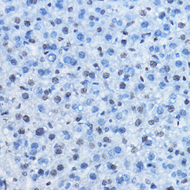 KO Validated Antibodies 1 Anti-CBX3 Antibody CAB2248KO Validated