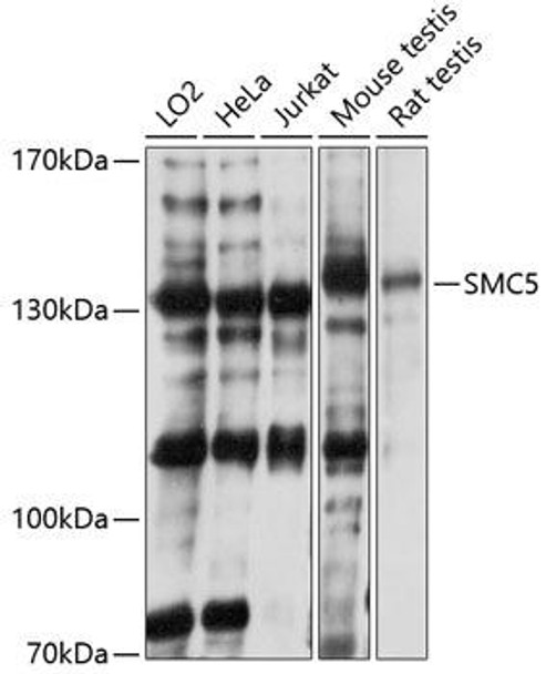 Cell Cycle Antibodies 1 Anti-SMC5 Antibody CAB2301