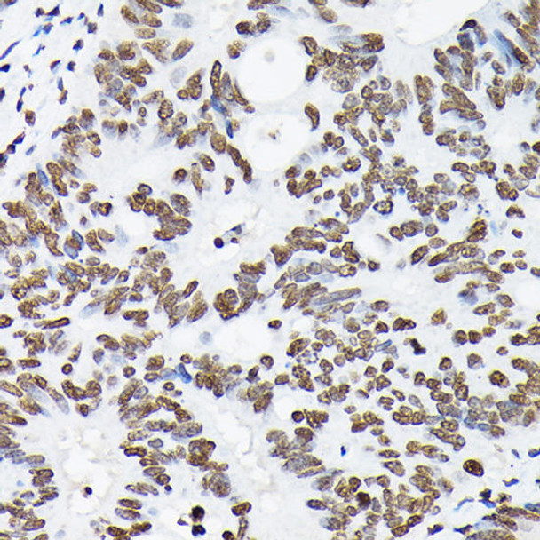 Epigenetics and Nuclear Signaling Antibodies 3 Anti-DiMethyl-Histone H3-K9 Antibody CAB2359