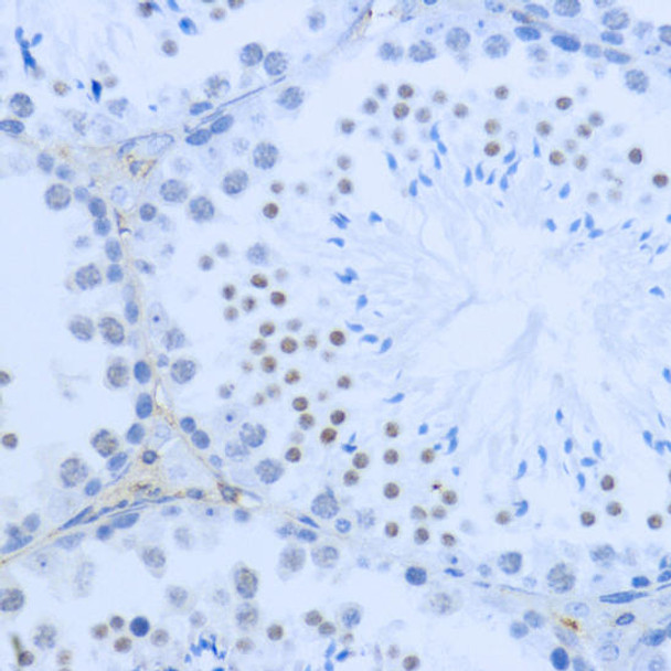 Epigenetics and Nuclear Signaling Antibodies 3 Anti-DiMethyl-Histone H3-K36 Antibody CAB2365