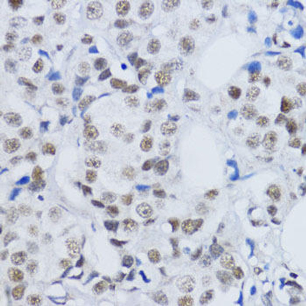 Epigenetics and Nuclear Signaling Antibodies 3 Anti-DiMethyl-Histone H3-K79 Antibody CAB2368