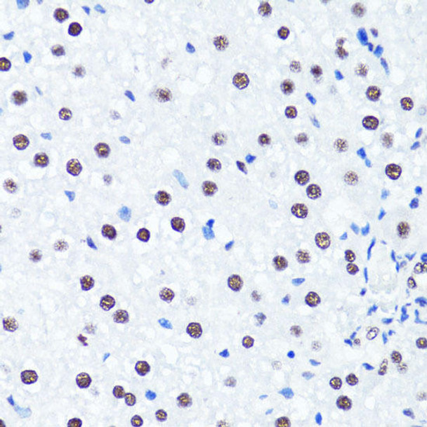 Epigenetics and Nuclear Signaling Antibodies 3 Anti-Symmetric DiMethyl-Histone H3-R2 Antibody CAB2373